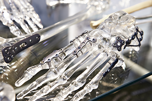 チタンを利用して作られた人工骨などの画像